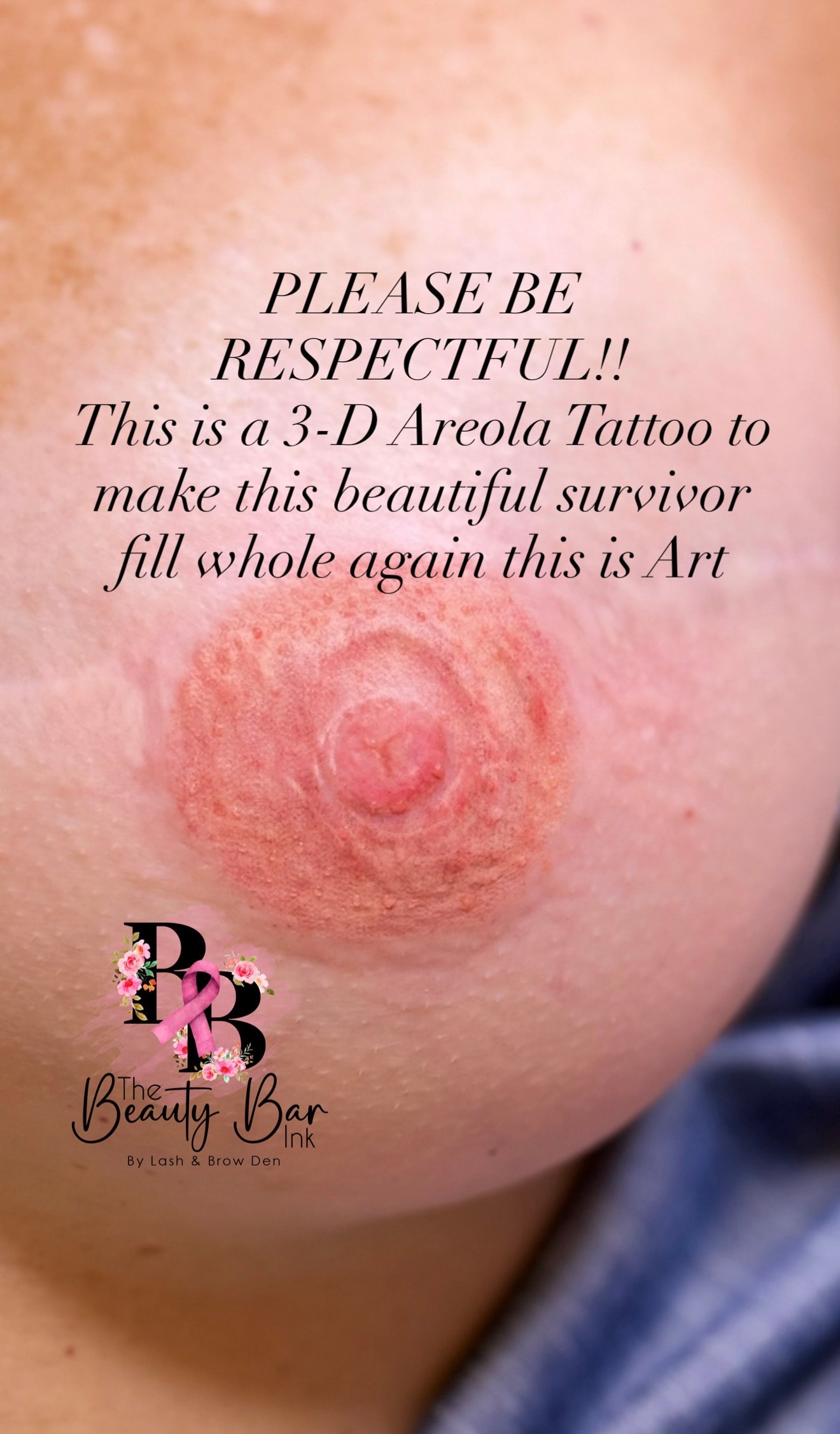 3-D areola tattoo to help survivor feel whole again