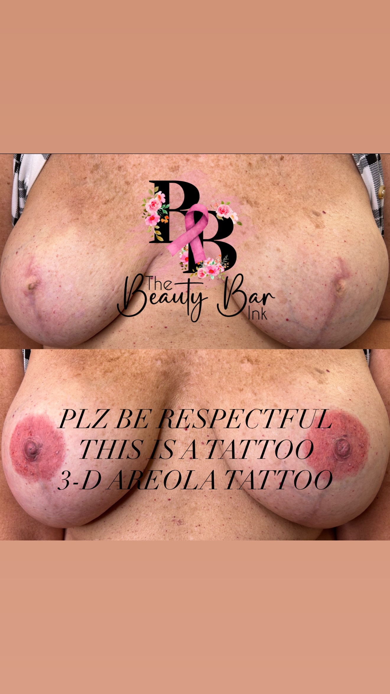 Before and after 3-D areola tattoo branded collage