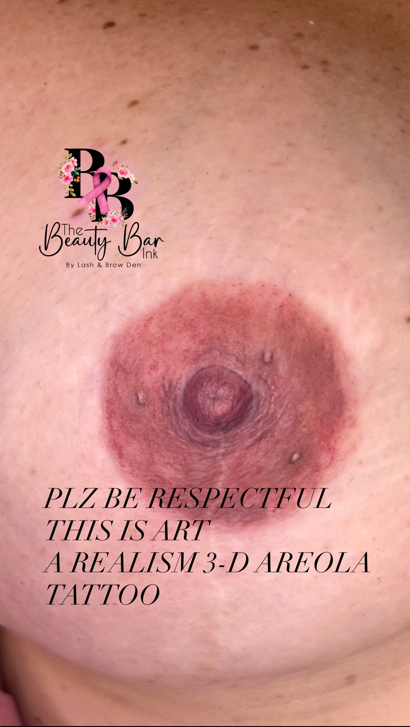 Realism 3-D areola tattoo close up result