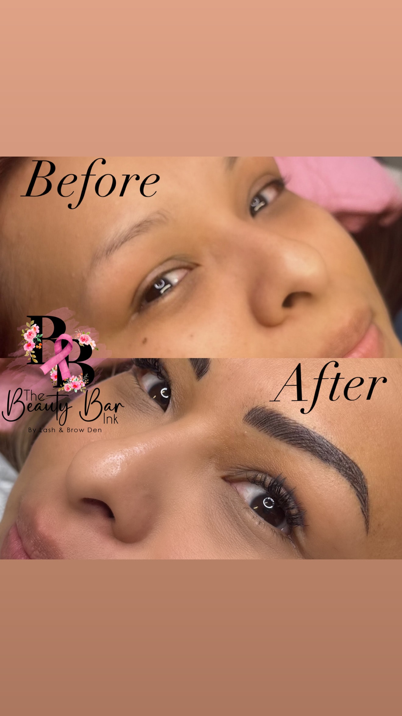 Dramatic brow before and after transformation