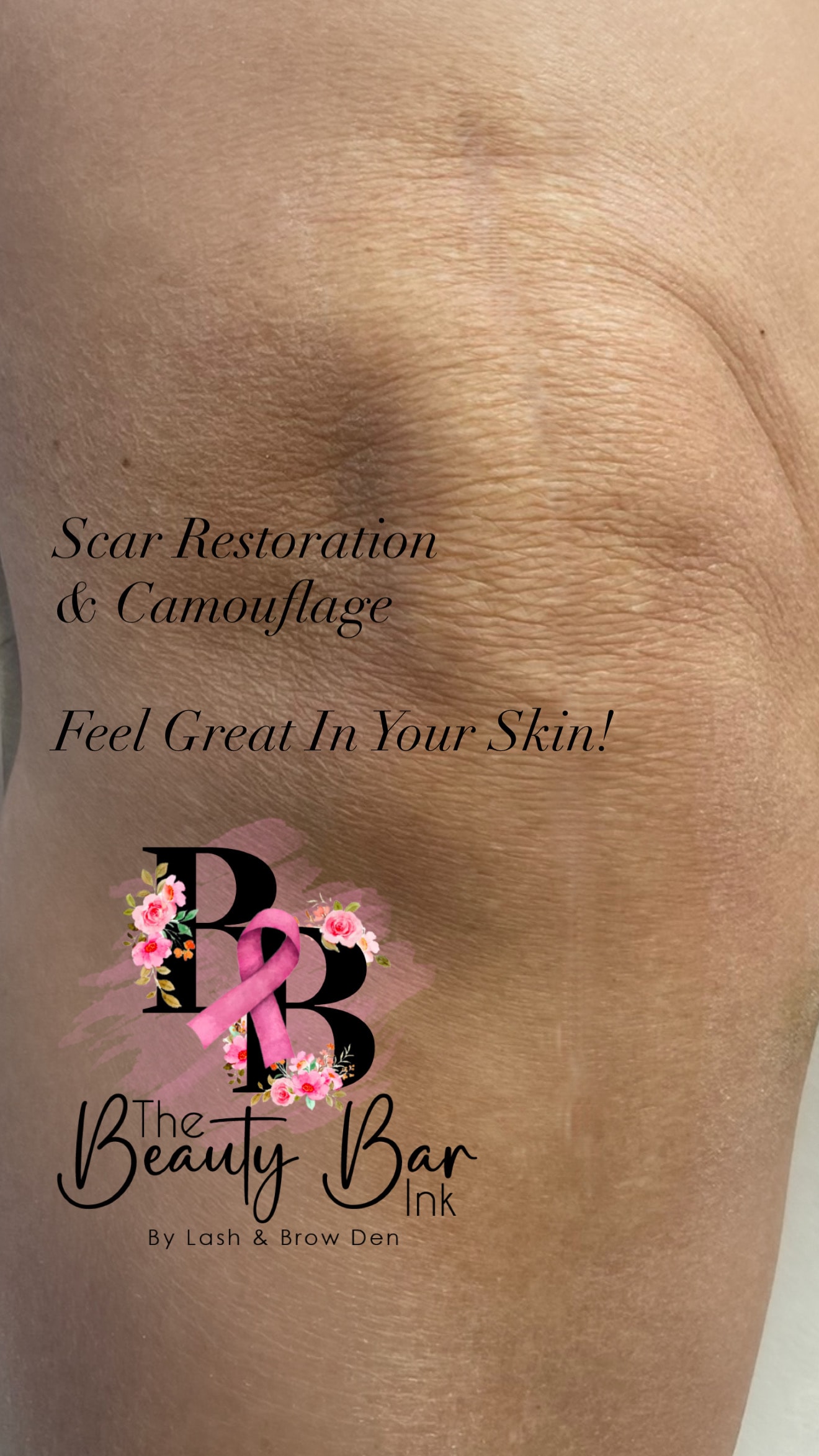 Scar restoration and camouflage feel great in your skin